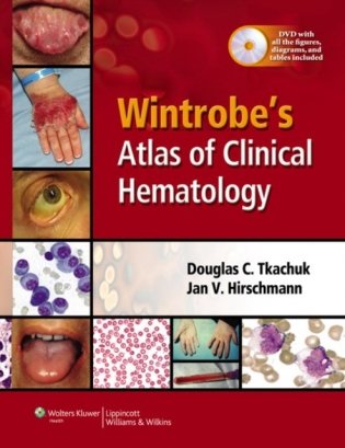 Wintrobe&apos;s Atlas of Clinical Hematology фото книги