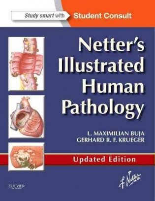 Netter's Illustrated Human Pathology фото книги