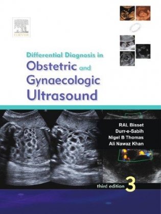 Differential Diagnosis in Obstetrics and Gynecologic Ultrasound фото книги