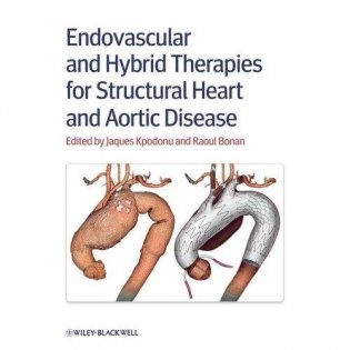 Endovascular and Hybrid Therapies for Structural Heart and Aortic Disease фото книги