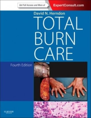 Total Burn Care, фото книги