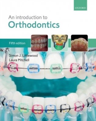 An Introduction to Orthodontics фото книги