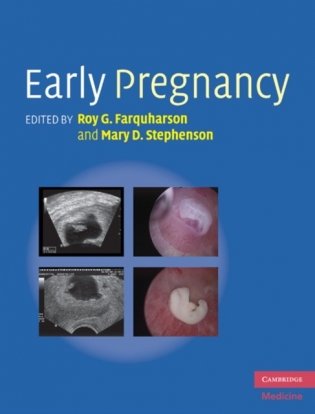 Early Pregnancy фото книги