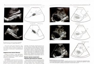 Практическая ультразвуковая диагностика. Том 2. Ультразвуковая диагностика заболеваний органов мочевыделительной системы и мужских половых органов фото книги 2