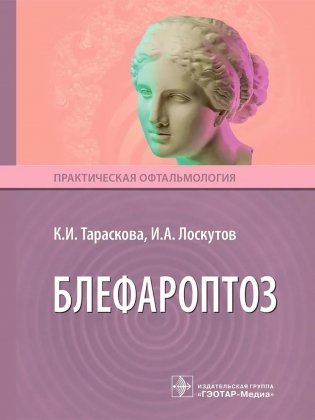 Блефароптоз фото книги