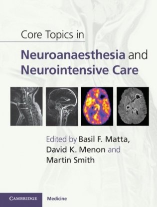 Core Topics in Neuroanaesthesia and Neurointensive Care фото книги