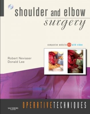 Operative Techniques: Shoulder and Elbow Surgery фото книги