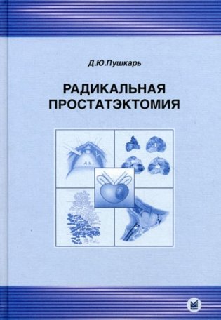 Радикальная простатэктомия. 3-е изд., без изм фото книги