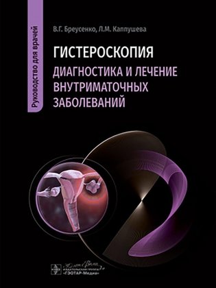 Гистероскопия. Диагностика и лечение внутриматочных заболеваний: руководство для врачей фото книги