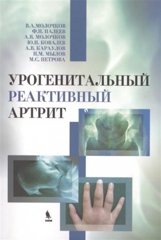 Урогенитальный реактивный артрит фото книги