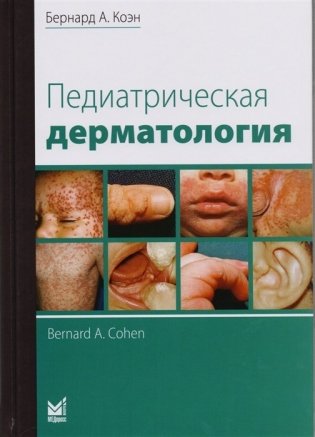 Педиатрическая дерматология фото книги