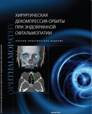 Хирургическая декомпрессия орбиты при эндокринной офтальмопатии фото книги