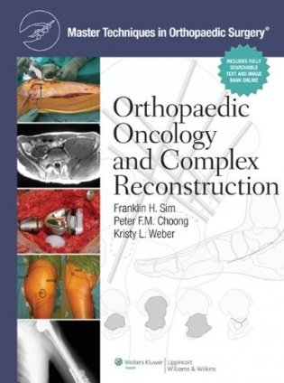 Master Techniques in Orthopaedic Surgery: Orthopaedic Oncology & Complex Reconstruction фото книги