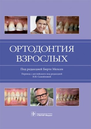 Ортодонтия взрослых фото книги
