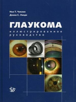 Глаукома. Иллюстрированное руководство фото книги