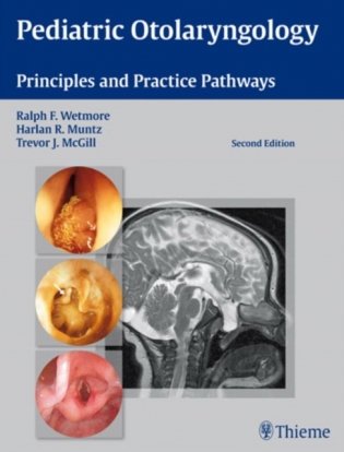 Pediatric Otolaryngology. Principles and Practice Pathways фото книги