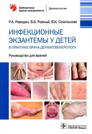 Инфекционные экзантемы у детей в практике врача-дерматовенеролога: руководство для врачей фото книги