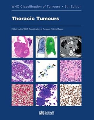 Thoracic Tumours фото книги