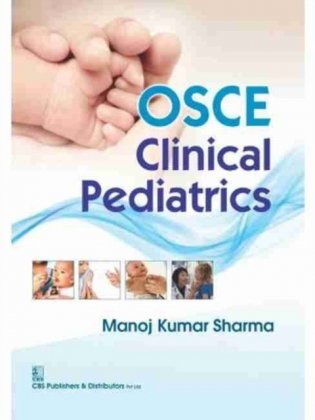 Osce Clinical Pediatrics фото книги