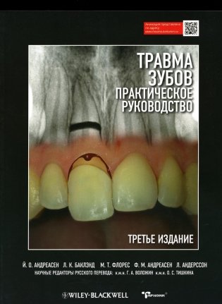 Травма зубов. Практическое руководство. 3-е изд фото книги