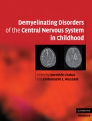 Demyelinating Disorders of the Central Nervous System in Childhood фото книги