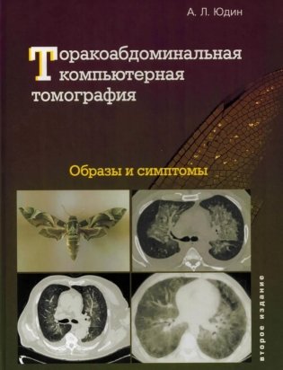Торакоабдоминальная компьютерная томография. Образы и симптомы фото книги