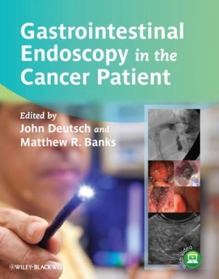 Gastrointestinal Endoscopy in the Cancer Patient фото книги