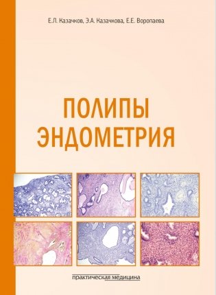 Полипы эндометрия: Учебное пособие фото книги