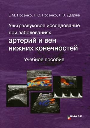 Ультразвуковое исследование при заболеваниях артерий и вен нижних конечностей. Учебное пособие фото книги