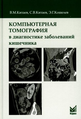 Компьютерная томография в диагностике заболеваний кишечника. 2-е изд фото книги