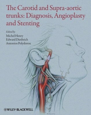 The Carotid and Supra-Aortic Trunks: Diagnosis, Angioplasty and Stenting, 2nd Edition The Carotid and Supra-Aortic Trunks: Diagnosis, Angioplasty and Stenting, 2nd Edition фото книги