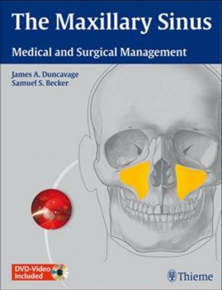 The Maxillary Sinus: Medical and Surgical Management фото книги