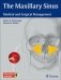 The Maxillary Sinus: Medical and Surgical Management фото книги маленькое 2