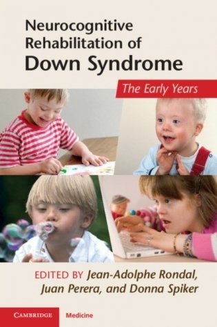 Neurocognitive Rehabilitation of Down Syndrome фото книги