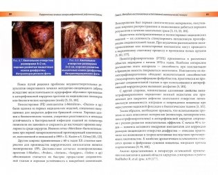 Хирургическое лечение гастроэзофагеальной рефлюксной болезни фото книги 2
