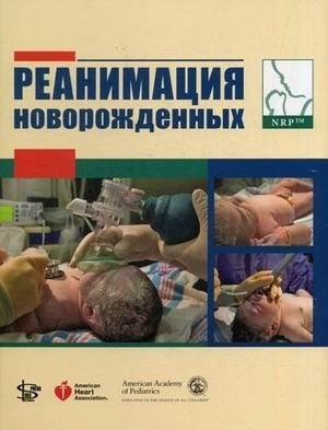 Реанимация новорожденных фото книги