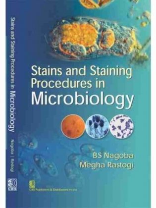 Stains And Staining Procedures In Microbiology (Pb 2017) фото книги