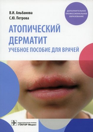 Атопический дерматит: Учебное пособие для врачей фото книги
