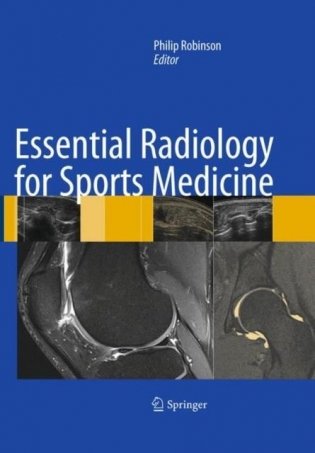 Essential Radiology for Sports Medicine фото книги
