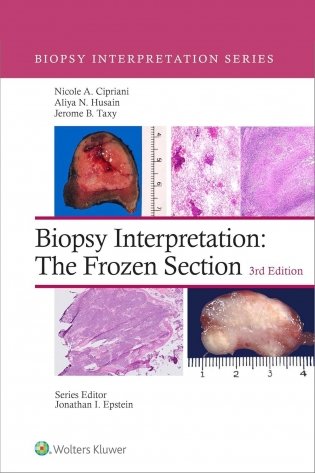 Biopsy Interpretation: The Frozen Section фото книги