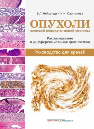 Опухоли женской репродуктивной системы. Распознавание и дифференциальная диагностика. Руководство для врачей фото книги