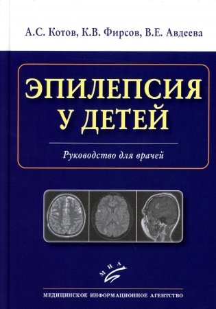 Эпилепсия у детей: Руководство для врачей фото книги