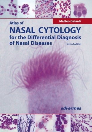 Atlas of nasal cytology for the differential diagnosis of nasal diseases фото книги
