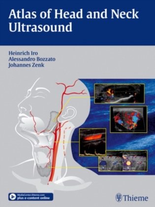 Atlas of Head and Neck Ultrasound фото книги
