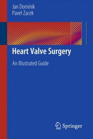 Heart Valve Surgery фото книги