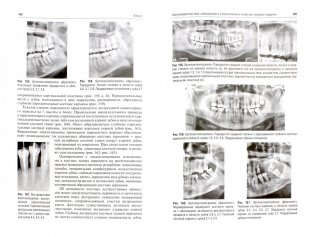Рентгенологические исследования в стоматологии и челюстно-лицевой хирургии фото книги 2