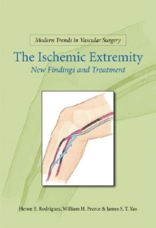 Modern Trends In Vascular Surgery: Ischemic Extremities фото книги
