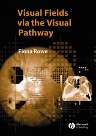 Visual Fields via the Visual Pathway фото книги