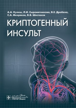Криптогенный инсульт фото книги