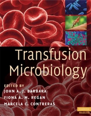 Transfusion Microbiology фото книги